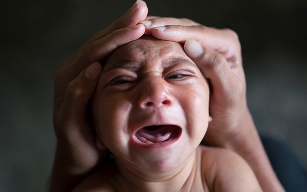 研究發(fā)現(xiàn)寨卡病毒誘發(fā)小頭癥的直接證據(jù)，但疫苗還是沒影｜美通社頭條